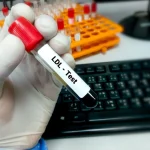 آزمایش LDL