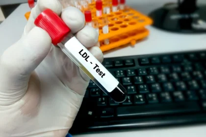 آزمایش LDL