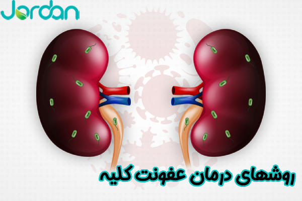 روشهای درمان عفونت کلیه