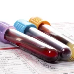 نام آزمایش ها