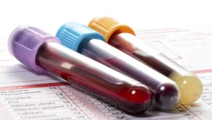 Name-of-the-tests نام آزمایش ها