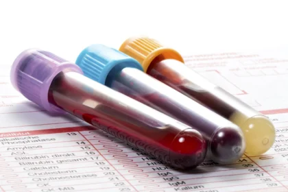 نام آزمایش ها