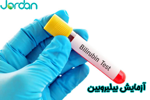 آزمایش بیلیروبین