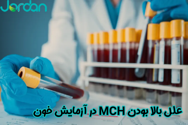 علل بالا بودن MCH