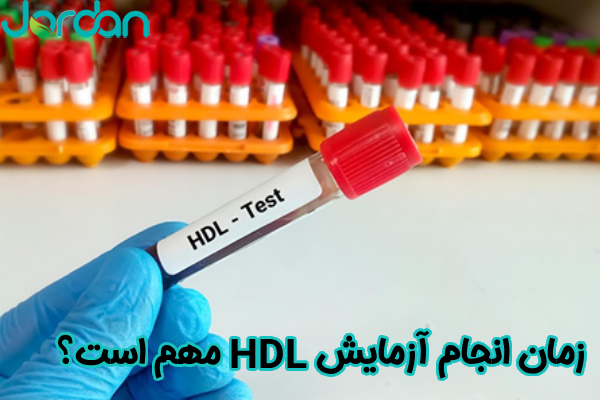 زمان آزمایش HDL مهم است؟