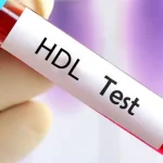 آزمایش HDL