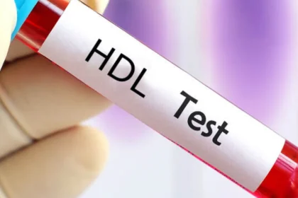 آزمایش HDL