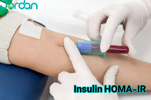 Insulin – HOMA-IR