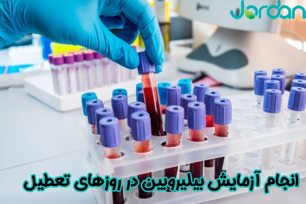 انجام آزمایش بیلیروبین در روزهای تعطیل