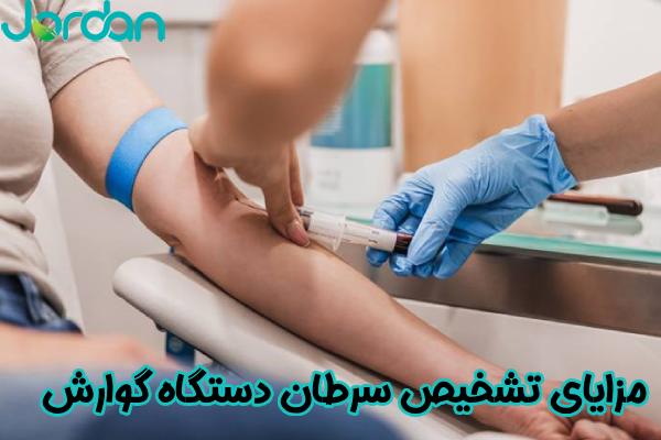 مزایای تشخیص سرطان گوارش