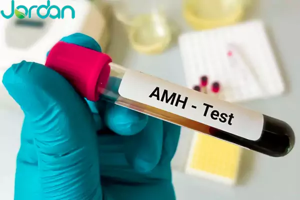 ورمون ضد مولرین AMH