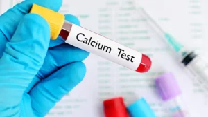 Calcium-test آزمایش کلسیم