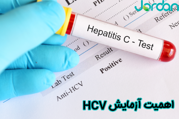 اهمیت آزمایش HCV
