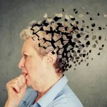 آلزایمر