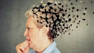 آلزایمر آلزایمر