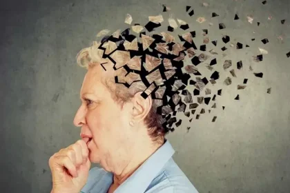 آلزایمر آلزایمر