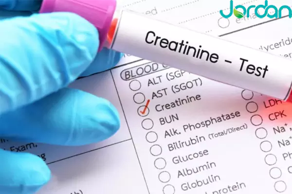 روند انجام آزمایش کراتینین