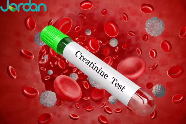 نتایج آزمایش کراتینین