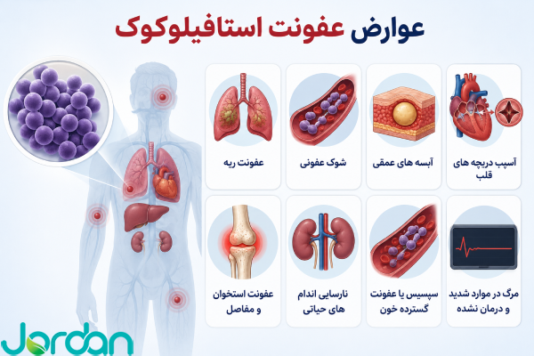 عوارض عفونت استاف