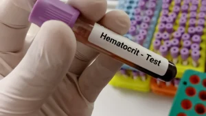 Hematocrit-test آزمایش هماتوکریت