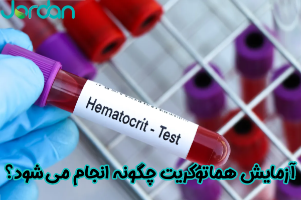 آزمایش هماتوکریت چگونه انجام می شود؟