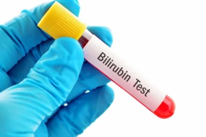Bilirubin test آزمایش بیلی روبین