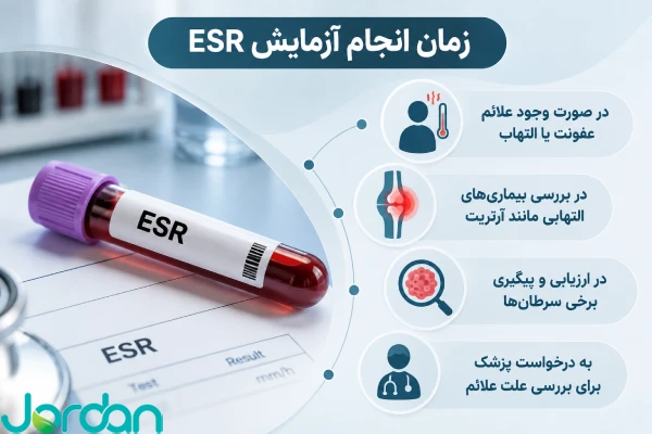 زمان انجام آزمایش ESR