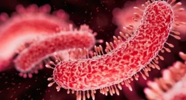 Tuberculosis بیماری سل